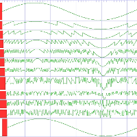 Pipelined ADC residuals